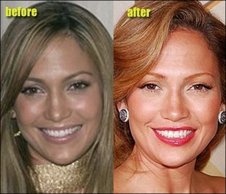 Jennifer Lopez J-Lo - Plastische Chirurgie zwickt für perfektes Aussehen?  