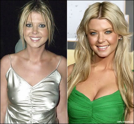 Tara Reid Plastische Chirurgie vor und nach Fotos, Bilder  