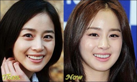 Kim Tae Hee Plastische Chirurgie vor und nach Gesicht Fotos  