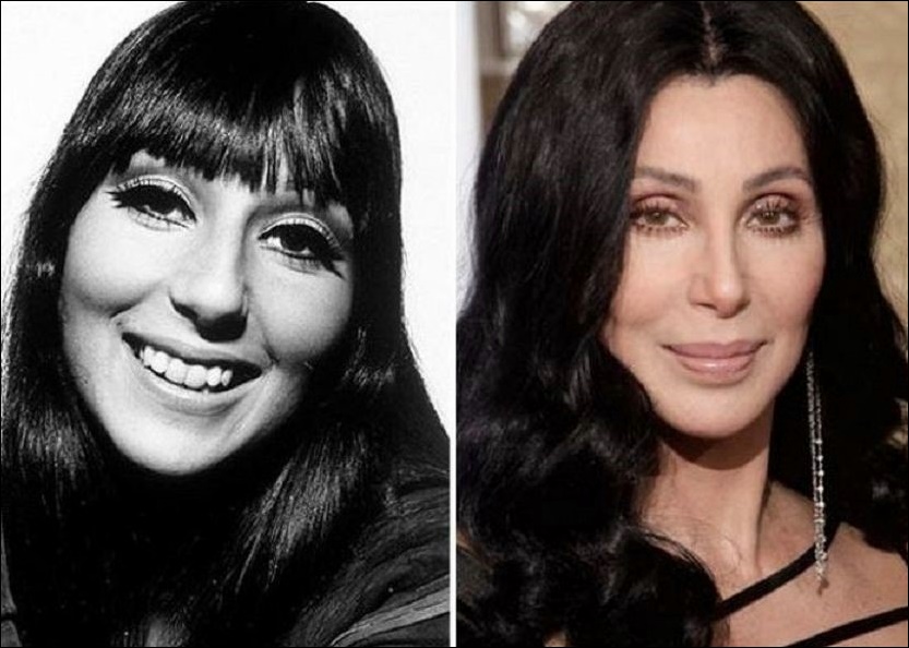 Cher mehrere Schönheitsoperationen für jugendliches Aussehen?  