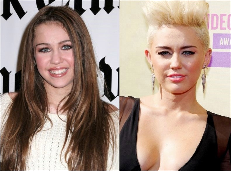 Miley Cyrus plastische Chirurgie Verfahren für besseres Aussehen  