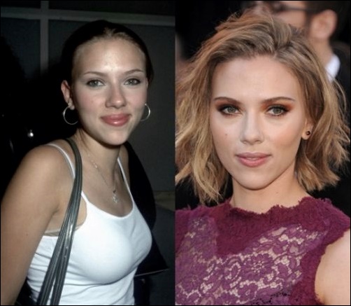 Scarlett Johansson Nase Job und Brustimplantate  