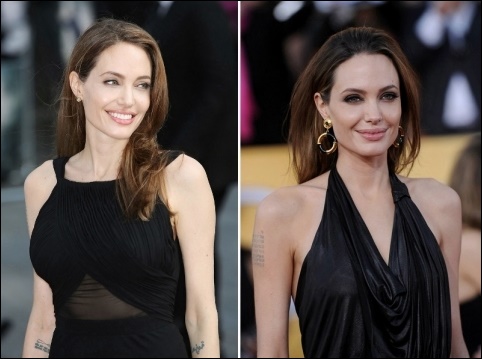Angelina Jolie Doppel-Mastektomie Chirurgie vor und nach den Bildern  