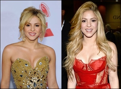 Shakira Brustimplantate Plastische Chirurgie vor und nach Titten Job  