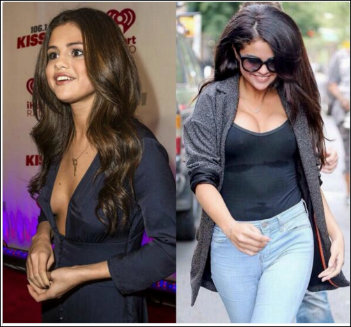 Selena Gomez Brustimplantat Plastische Chirurgie Vorher-Nachher Bilder  