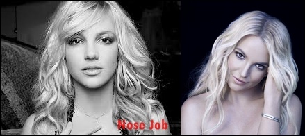 Britney Spears Nase Job Plastische Chirurgie vor und nach Nasenkorrektur  
