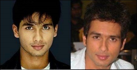 Bollywood Male Actors Plastische Chirurgie vor und nach Fotos  