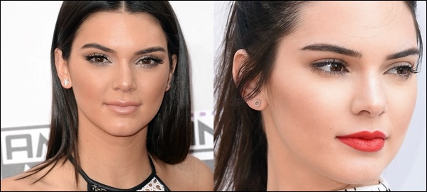 Kendall Jenner Lip Injektion plastische Chirurgie vor und nach Lippen Instagram  
