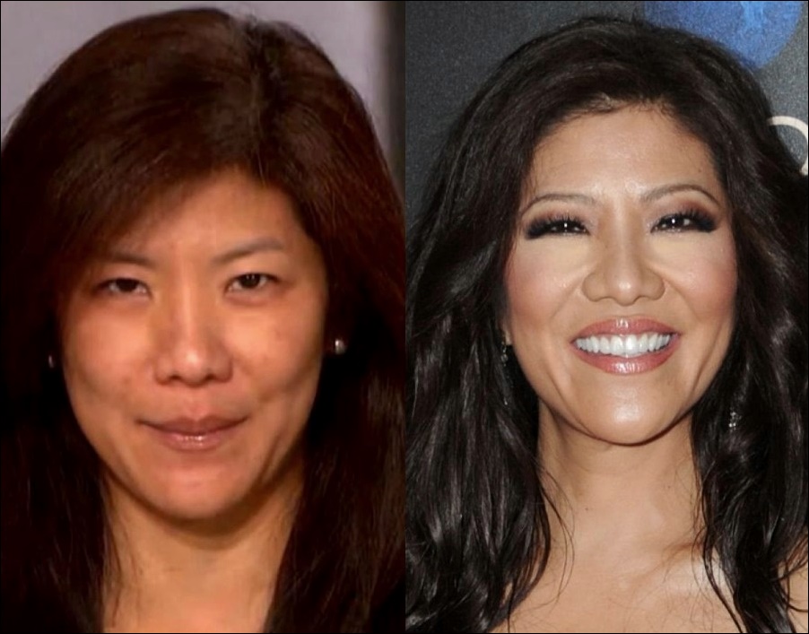 Julie Chen vor und nach der plastischen Chirurgie  