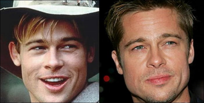 Brad Pitt Plastische Chirurgie vor und nach Facelift, Nase Job  