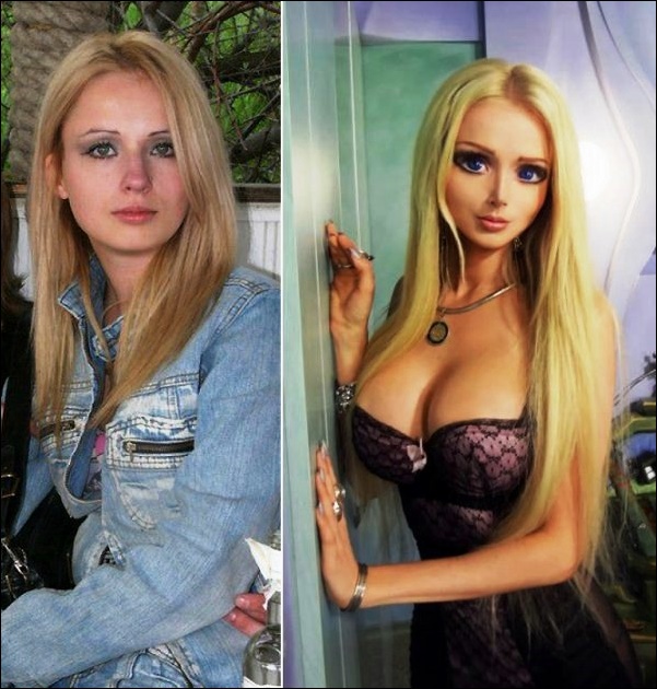 Barbie plastische Chirurgie Mädchen vor und nach Bildern  