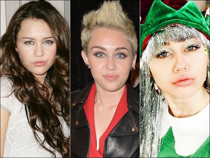 Miley Cyrus Lip Injektionen Plastische Chirurgie vor und nach Fotos  