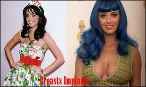 Katy Perry Implantate Plastische Chirurgie vor und nach Boob Job Fotos  