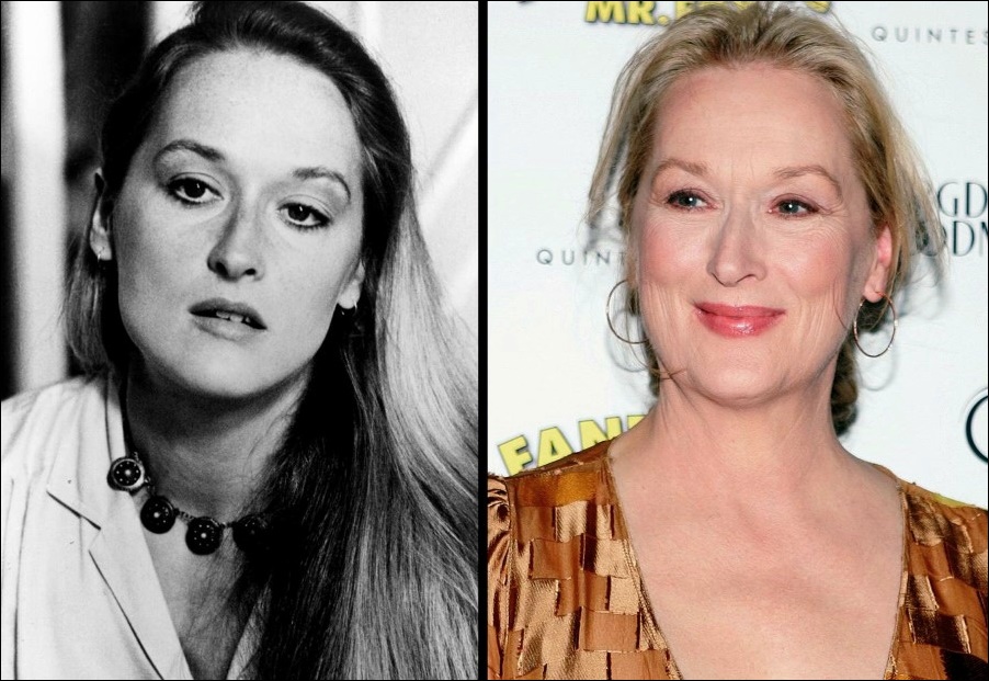 Meryl Streep ist gegen plastische Chirurgie?  