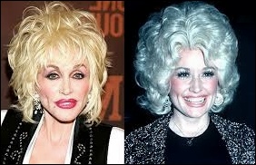 Dolly Parton Plastische Chirurgie vor und nach Botox, Füller Fotos  