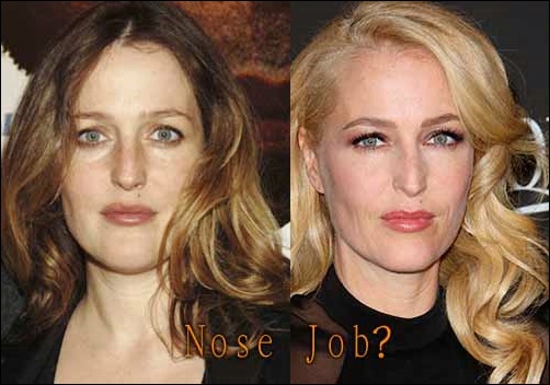 Gillian Anderson Nase Job Plastische Chirurgie vor und nach  