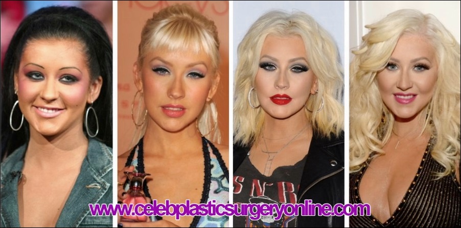 Christina Aguilera Vor und nach der plastischen Chirurgie  