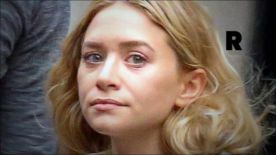 Ashley Olsen - Sind Gerüchte über verpfuschte plastische Chirurgie wahr?  