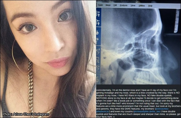 Arissa Cheo Plastische Chirurgie Gerüchte vor und nach Instagram  