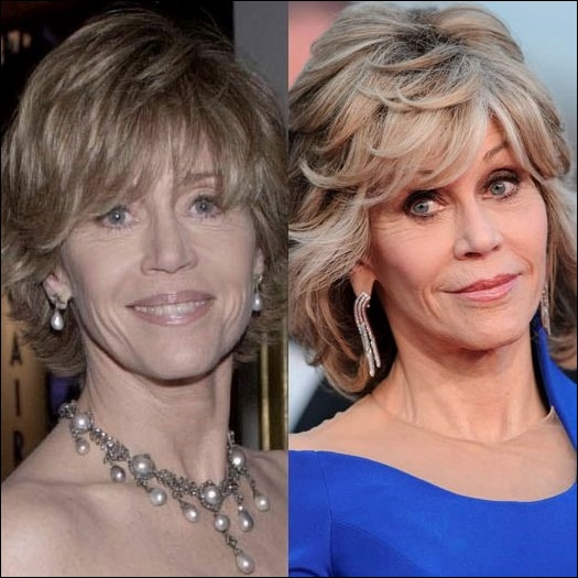 Jane Fonda mit Hilfe der plastischen Chirurgie immerwährend  