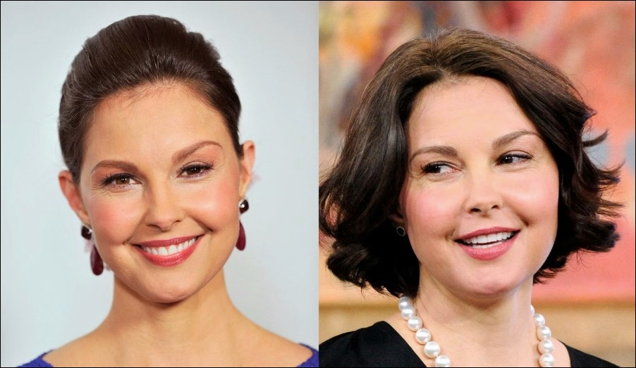 Ashley Judd Plastische Chirurgie oder Sinus-Infektion?  