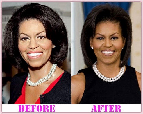 Michelle Obama Plastische Chirurgie vor und nach  