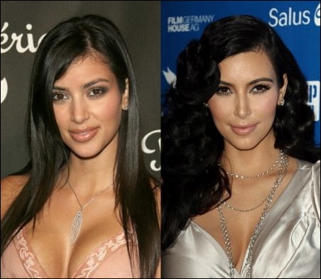 Kim Kardashian Nase Job - gute oder schlechte Nase Job?  