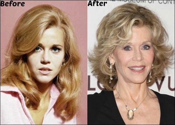 Jane Fonda mit Hilfe der plastischen Chirurgie immerwährend  