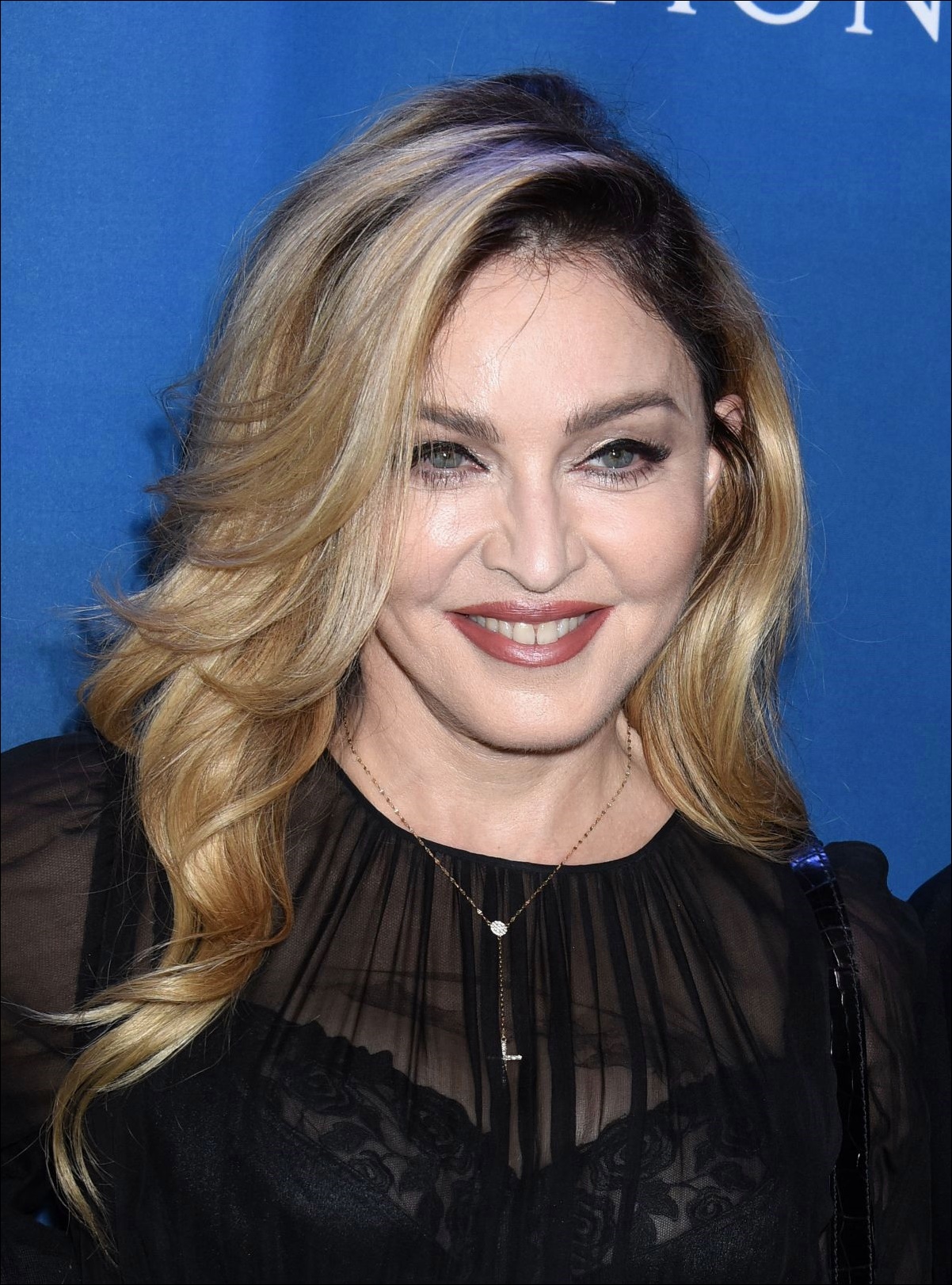 Madonna Plastische Chirurgie vor und nach Gesicht Fotos  