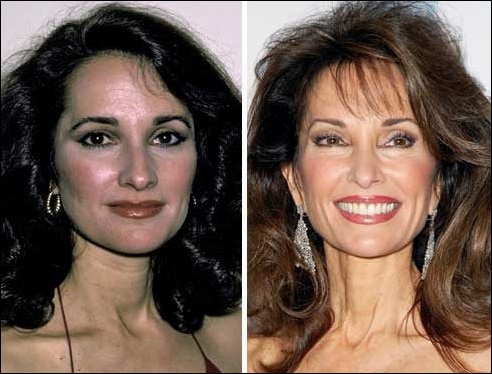 Susan Lucci Plastische Chirurgie - Ein kompletter Übergang zur Hinreißenden Schönheit  