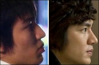 Lee Min Ho - Verbietet Mund und Nase plastische Chirurgie?  