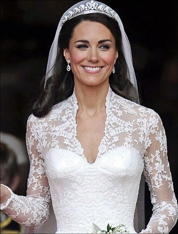 Kate Middleton Die Herzogin von Cambridge hatte Plastische Chirurgie erlitten?  