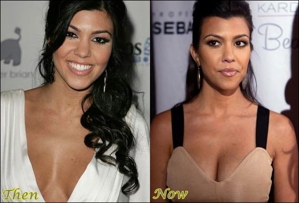 Kourtney Kardashian bestätigt plastische Chirurgie!  