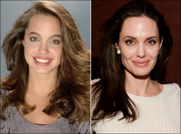 Angelina Jolie Nase Job Plastische Chirurgie vor und nach Fotos  