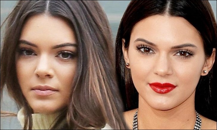 Kendall Jenner der jüngste aus dem Kardashian-Jenner-Clan nutzt Plastische Chirurgie?  