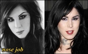 Kat Von D Plastische Chirurgie vor und nach Fotos  