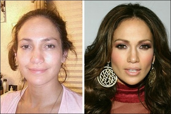 Warum ist Jennifer Lopez Plastische Chirurgie diskutierbar?  