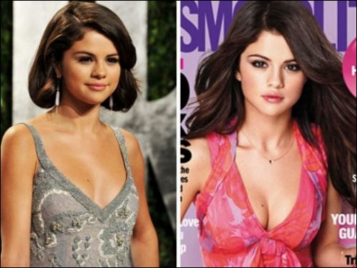 Selena Gomez Plastische Chirurgie für Justin Bieber?  