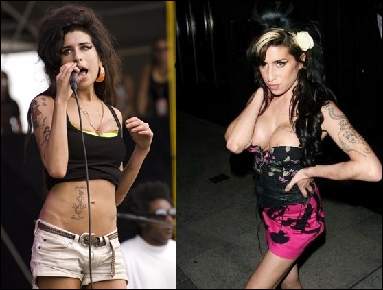 Amy Winehouse Brustverbesserung vor und nach Bildern  