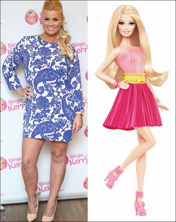 Kerry Katona Barbie Doll Plastische Chirurgie vor und nach Fotos  