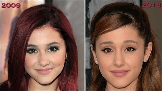 Ariana Grande Nase Job Plastische Chirurgie vor und nach den Bildern  