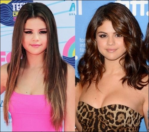 Selena Gomez Plastische Chirurgie für Justin Bieber?  