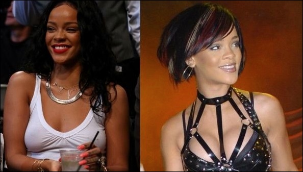 Rihanna sieht professioneller nach Plastische Chirurgie aus?  