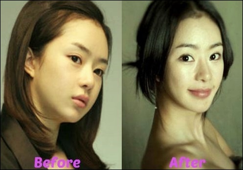 Seo Woo - Ein Erfolg in der plastischen Chirurgie  
