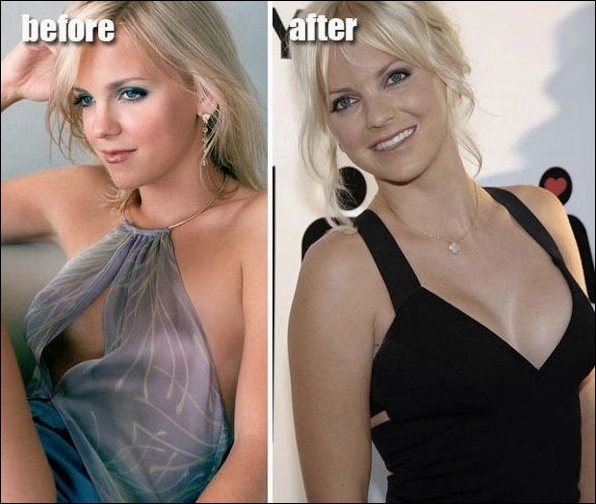 Anna Faris plastische Chirurgie für süße Komödiendarstellerin?  