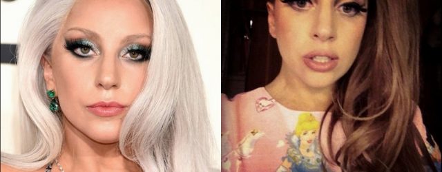 Lady Gaga Lip Injektionen vor und nach Fotos  