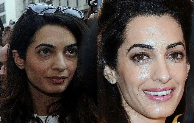 Amal Alamuddin Clooney vor und nach der plastischen Chirurgie  
