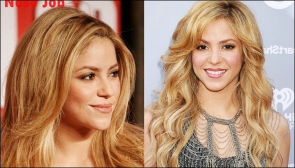 Shakira Nase Job Plastische Chirurgie vor und nach Nasenkorrektur Fotos  