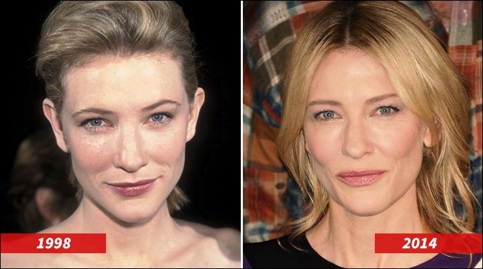 Cate Blanchett Plastische Chirurgie Vorher und Nachher  