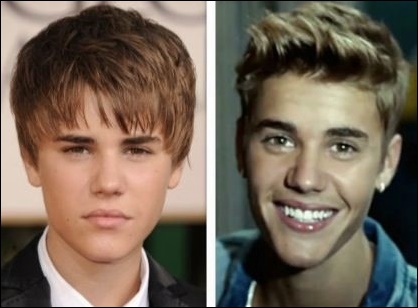 Justin Bieber Hat er plastische Chirurgie benutzt?  